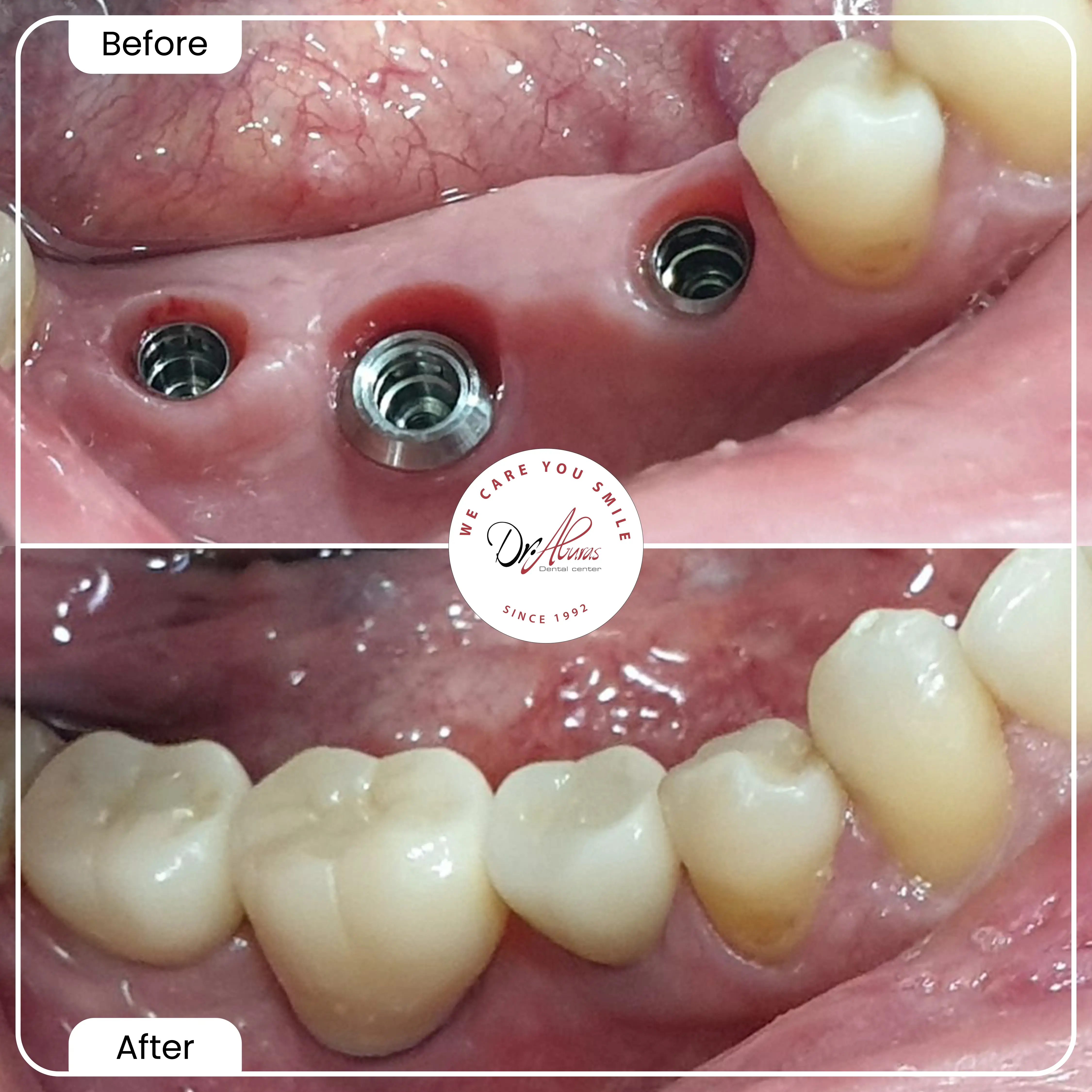 Before-and-After-Image